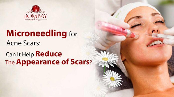 Microneedling