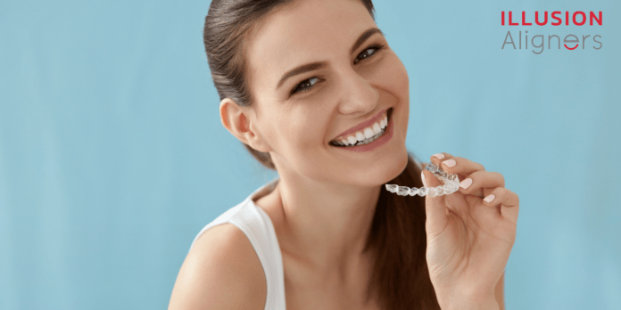 clear aligners